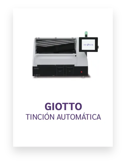 Giotto Tincion Automatica