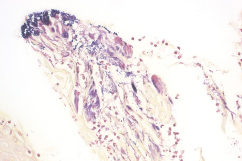 Kit BioGram Histo