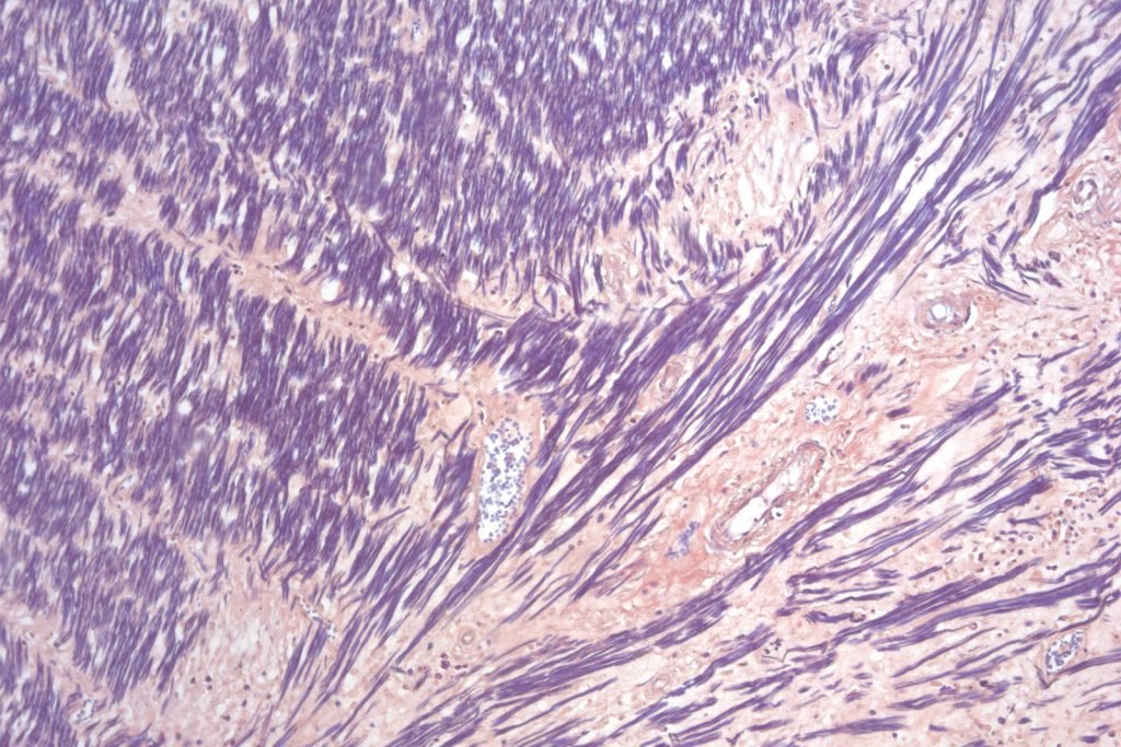 Kit de hematoxilina PTA