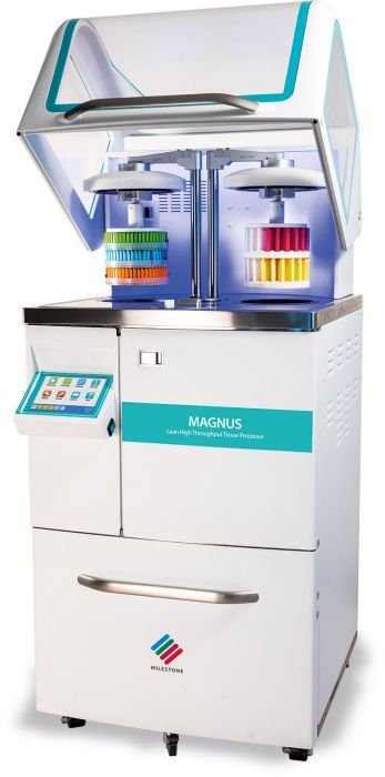 Magnus